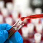 Shortage of Investigate Monkeys Puts U.S. at Chance for Wellness Emergencies