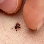 Tick-Borne Powassan Virus Can Kill — How to Defend Oneself