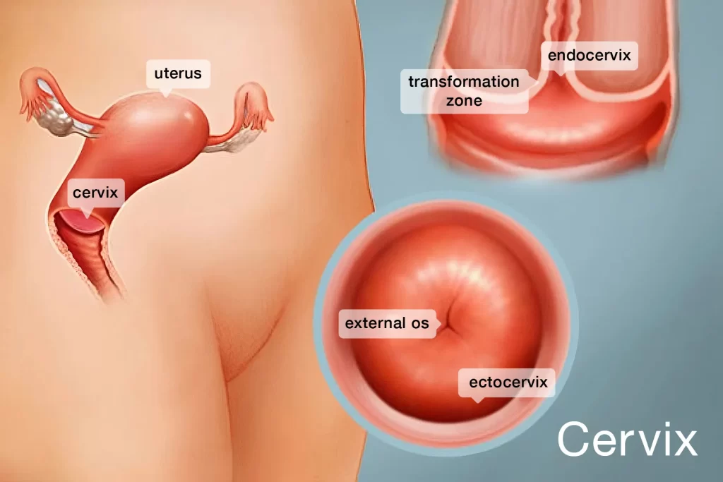 Cervical Cancer Screenings Double With Mailed Do-it-yourself Kits