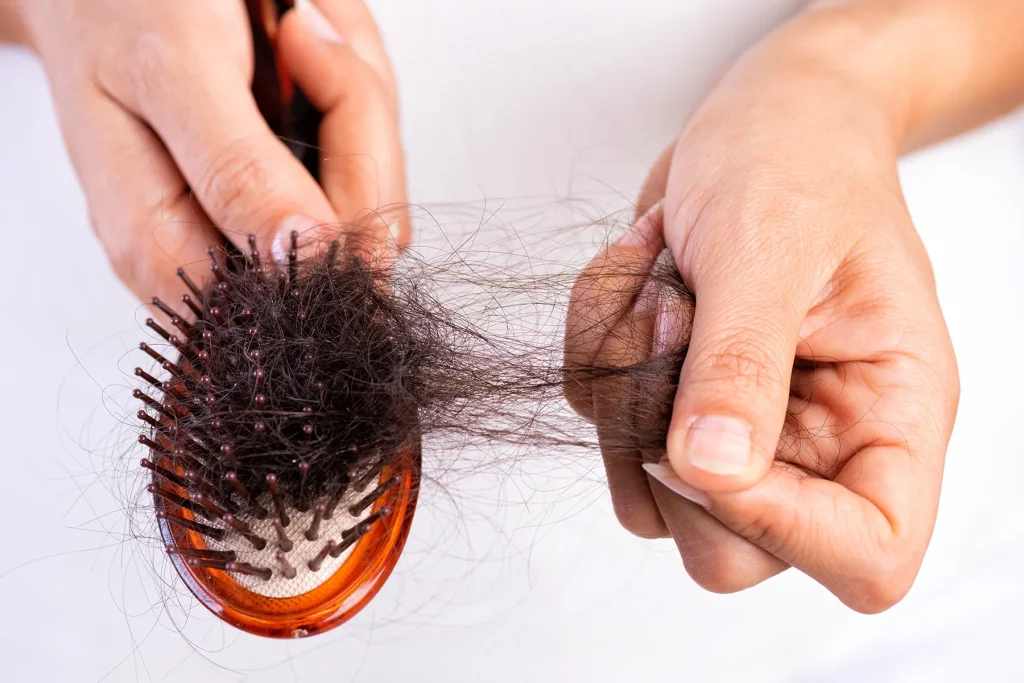Do Body weight Decline Prescription drugs Like Ozempic Lead to Hair Loss?