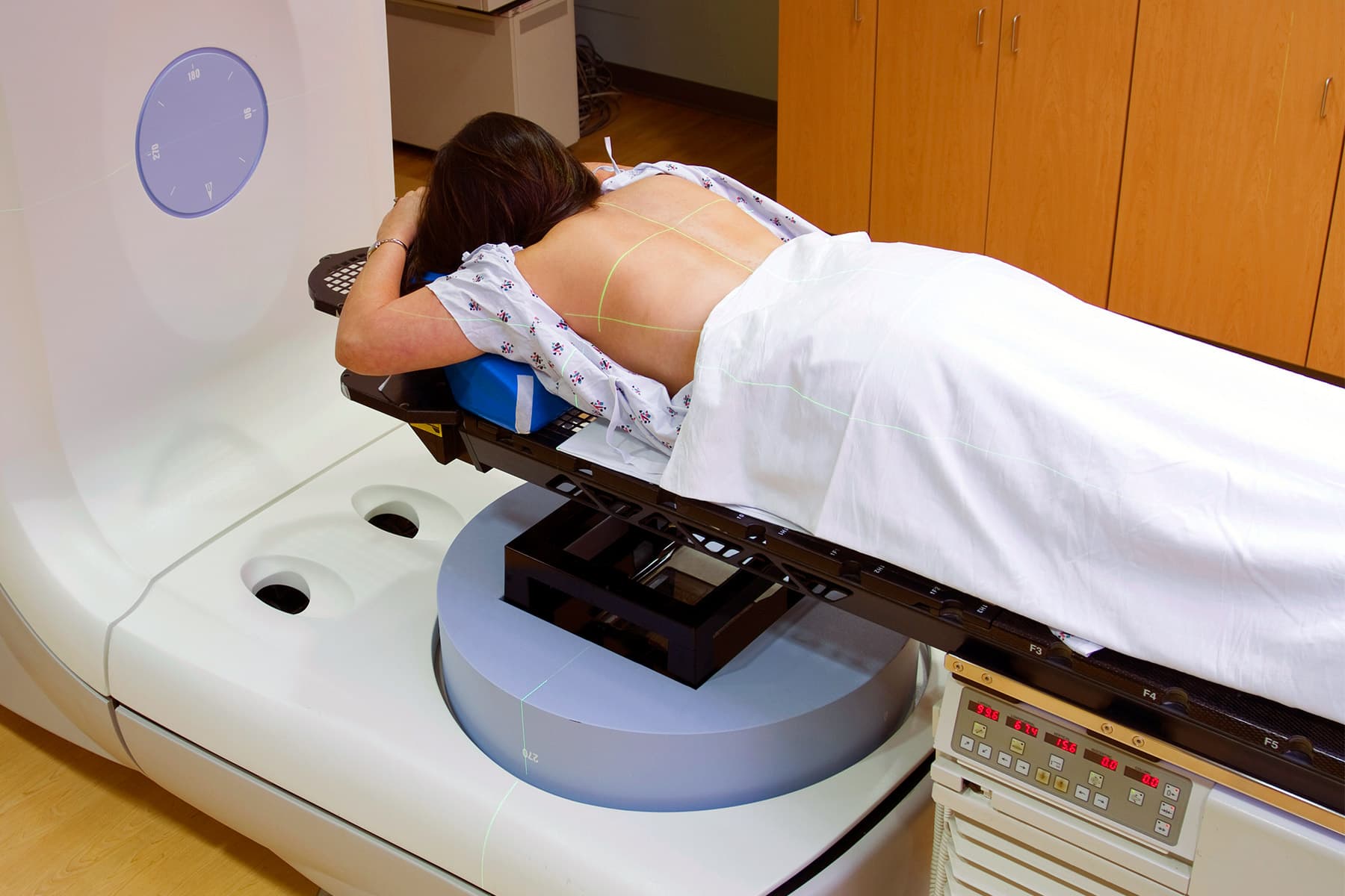 New Hope Versus Distressing Skin Concerns Induced by Radiation Treatment