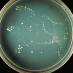 How Fungal Meningitis Outbreaks Can Occur just after Beauty Processes and Other Surgeries