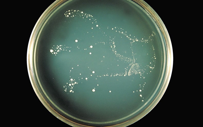 How Fungal Meningitis Outbreaks Can Occur just after Beauty Processes and Other Surgeries