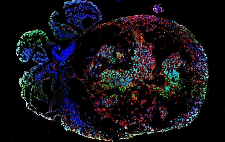 Lab-Developed Monkey Embryos Reveal in 3-D How Organs Start out