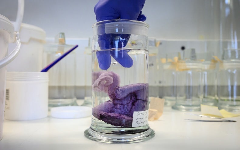 Thousands of New Creatures Found in Deep-Sea Mining Zone