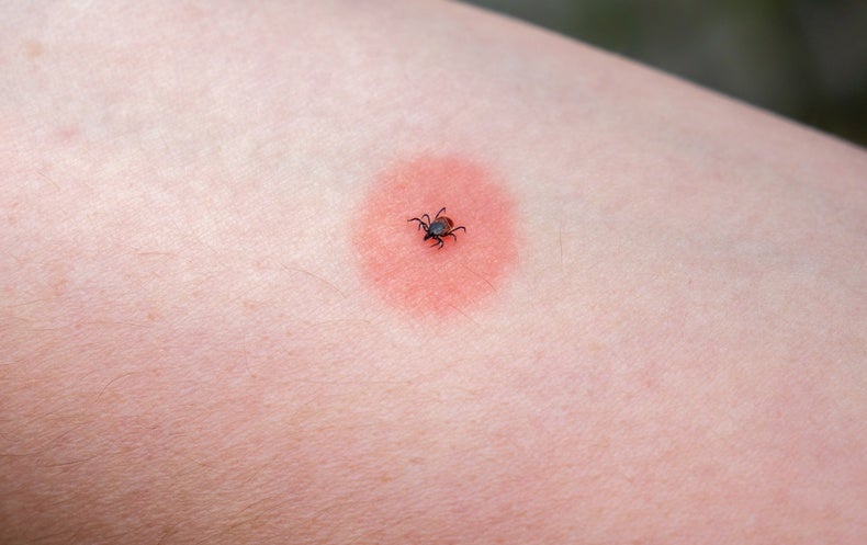 How to Shield Oneself from Ticks and the Dangerous Illnesses They Distribute