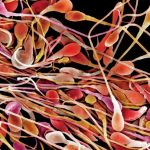 Are Sperm Counts Seriously Declining?