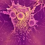 After COVID-19, Can mRNA Vaccines Support with Most cancers as Effectively?