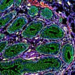 Cells Manage By themselves into ‘Neighborhoods’ That Could Condition Remedy