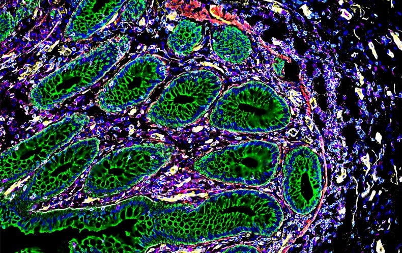 Cells Manage By themselves into ‘Neighborhoods’ That Could Condition Remedy
