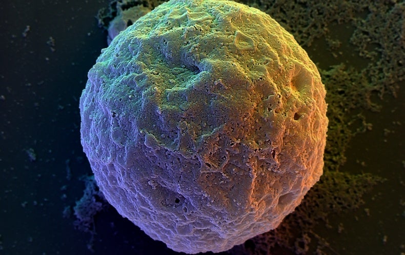 New Human Embryo Designs Spark Pointless Controversy