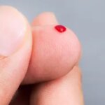 Finger-Prick Blood Exam Promising for Alzheimer’s Diagnosis