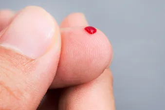Finger-Prick Blood Exam Promising for Alzheimer’s Diagnosis