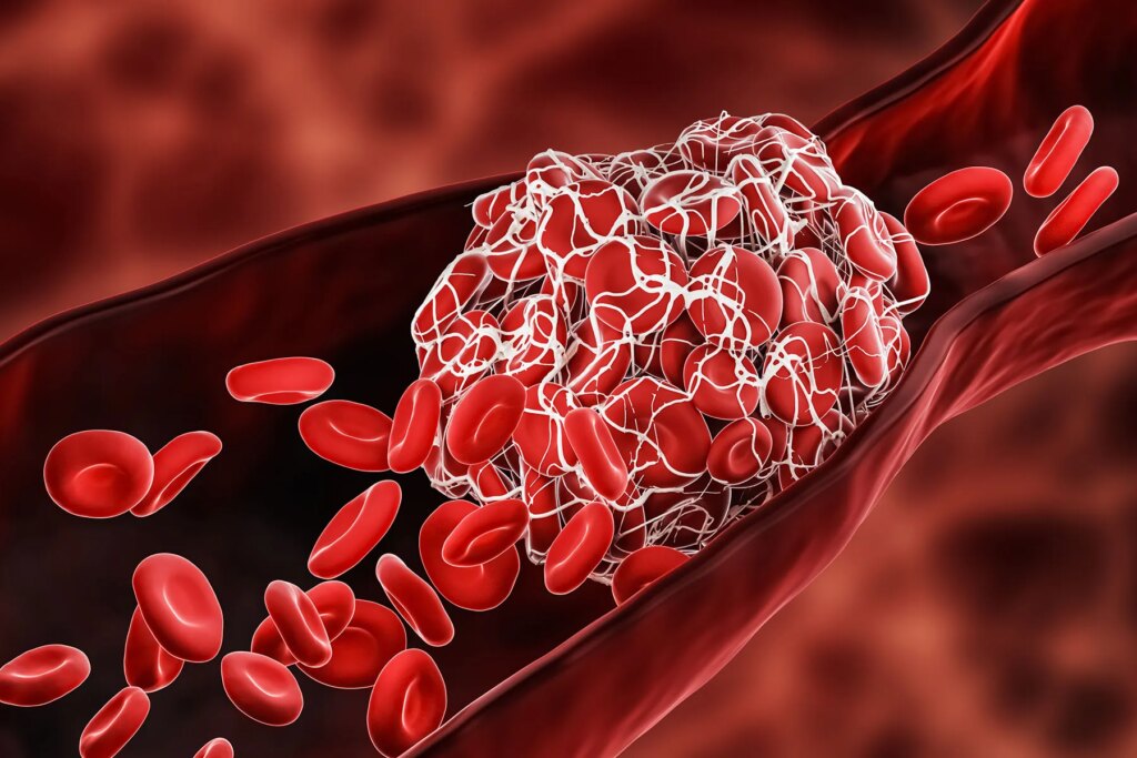 What Younger People today Should really Know About Stroke Hazards