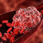 What Younger People today Should really Know About Stroke Hazards