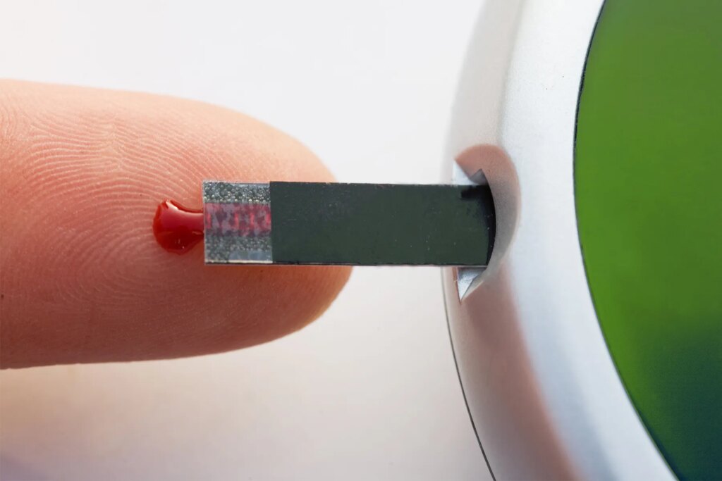 Cells from Cadaver Pancreas May well Help Deal with Style 1 Diabetes