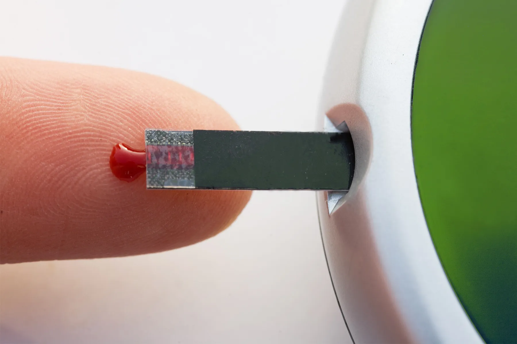 Cells from Cadaver Pancreas May well Help Deal with Style 1 Diabetes