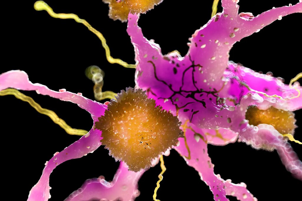 Food and drug administration Approves New Drug to Gradual Alzheimer’s Illness