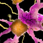 Food and drug administration Approves New Drug to Gradual Alzheimer’s Illness