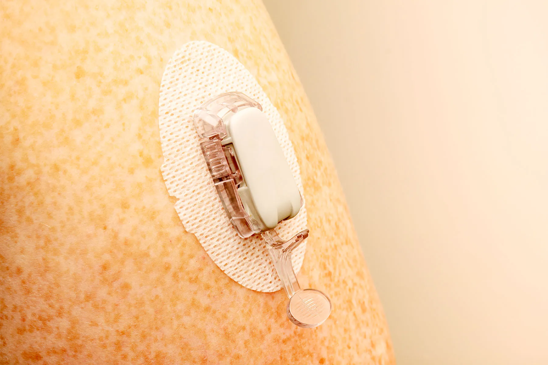 A Very small Patch Might Someday Measure Your Vital Wellness Wants