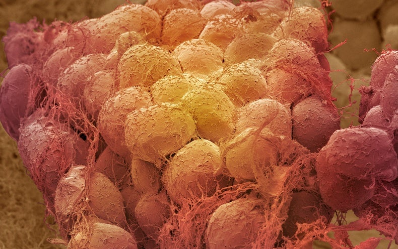 Outside of Ozempic: New Obesity Medicines Could Be Cheaper and Even A lot more Productive