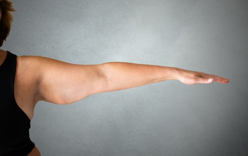 Why You Will not Just Drop Fats When You happen to be on a Diet program
