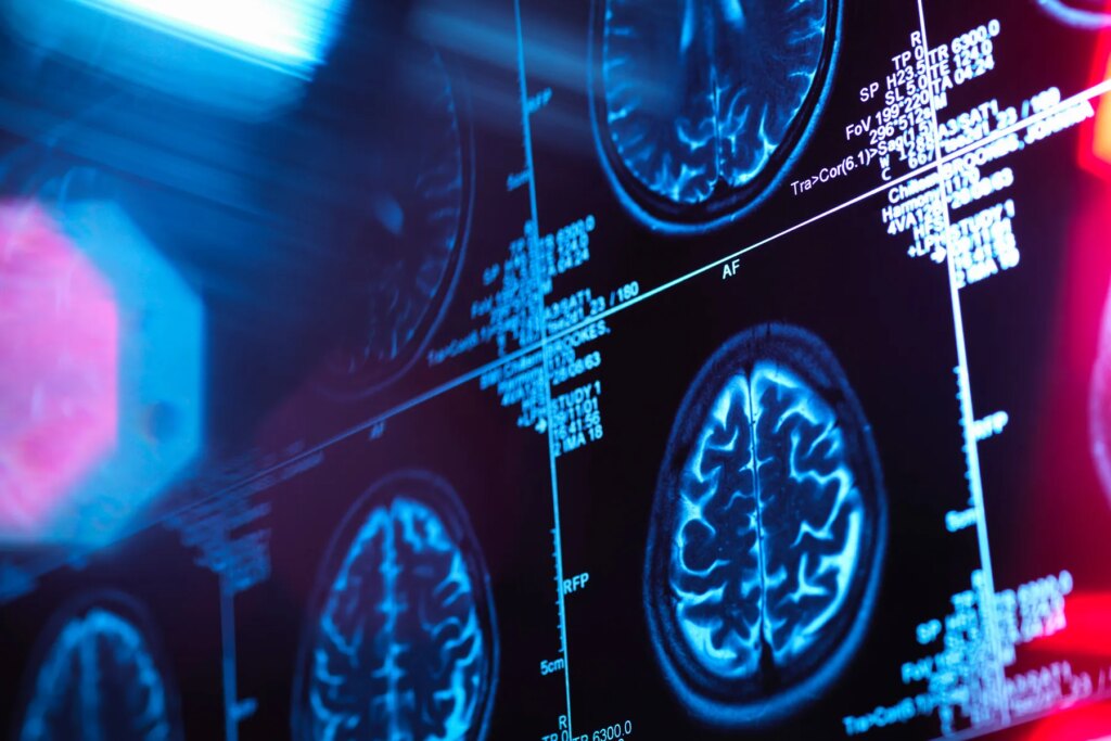Food and drug administration Alright of Alzheimer’s Drug Brings Hope, Some Safety Worries