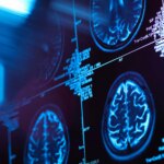 Food and drug administration Alright of Alzheimer’s Drug Brings Hope, Some Safety Worries