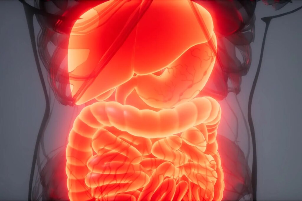 A lot more Than 2 Million in U.S. Have Inflammatory Bowel Condition