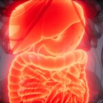A lot more Than 2 Million in U.S. Have Inflammatory Bowel Condition