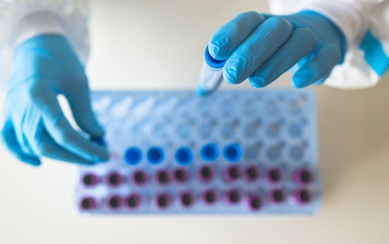 Why a Really Mutated Coronavirus Variant Has Experts on Alert