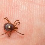 Pink Meat Allergy Prompted by Tick Chunk Is Spreading–And Nearly Half of Health professionals You should not Know about It