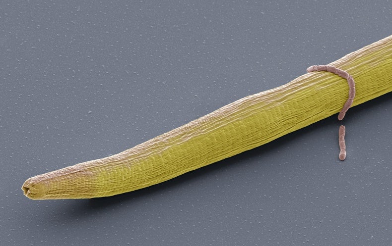 Worm Brains, Decoded like Never ever Prior to, Could Get rid of Light on Our Have Head