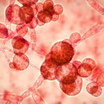As Superfungi Spread, the CDC Raises Alarms
