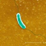 Flesh-Consuming Microorganisms Bacterial infections Are on the Rise in the U.S. Here’s How to Remain Safe