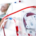 My Dialysis Device Performs as My Kidneys, for Now