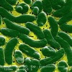 Flesh-Taking in Microbes Instances Spiked in Florida immediately after Hurricane Ian