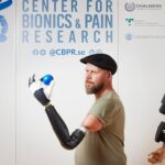 Over-Elbow Bionic Arm Can Control Each and every Finger