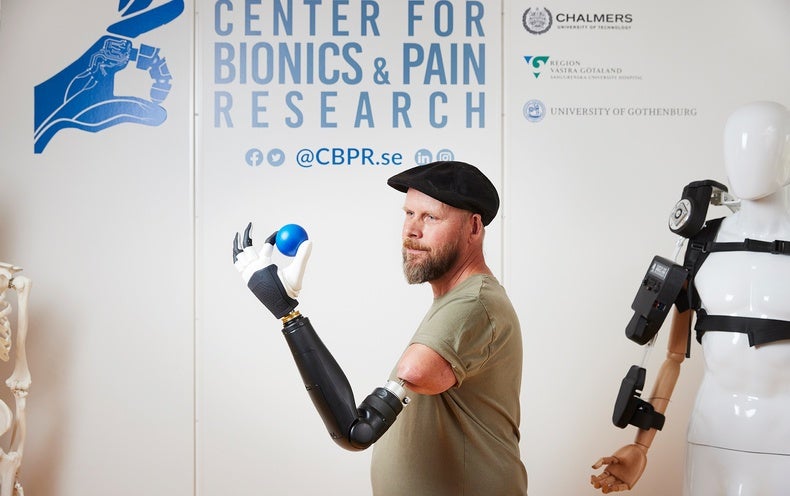 Over-Elbow Bionic Arm Can Control Each and every Finger