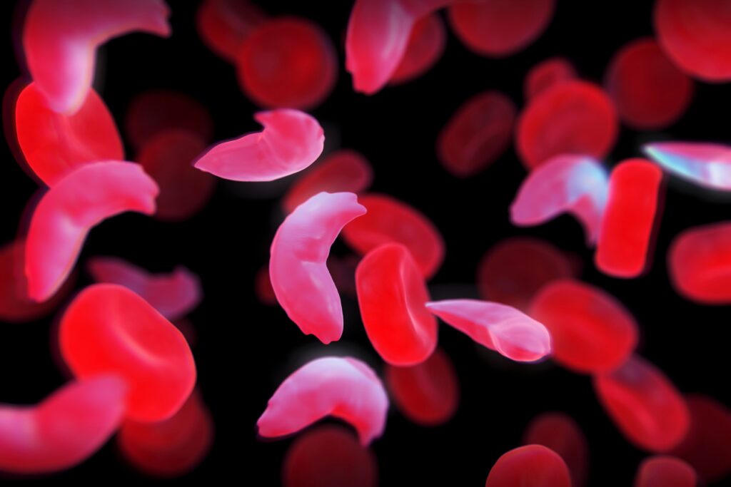 U.K. Results in being 1st State to Approve a CRISPR Illness Remedy