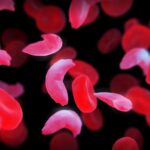 U.K. Results in being 1st State to Approve a CRISPR Illness Remedy