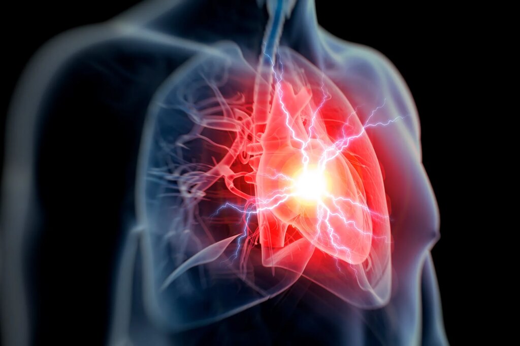 Upper body Agony and Other Indications