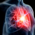 Upper body Agony and Other Indications