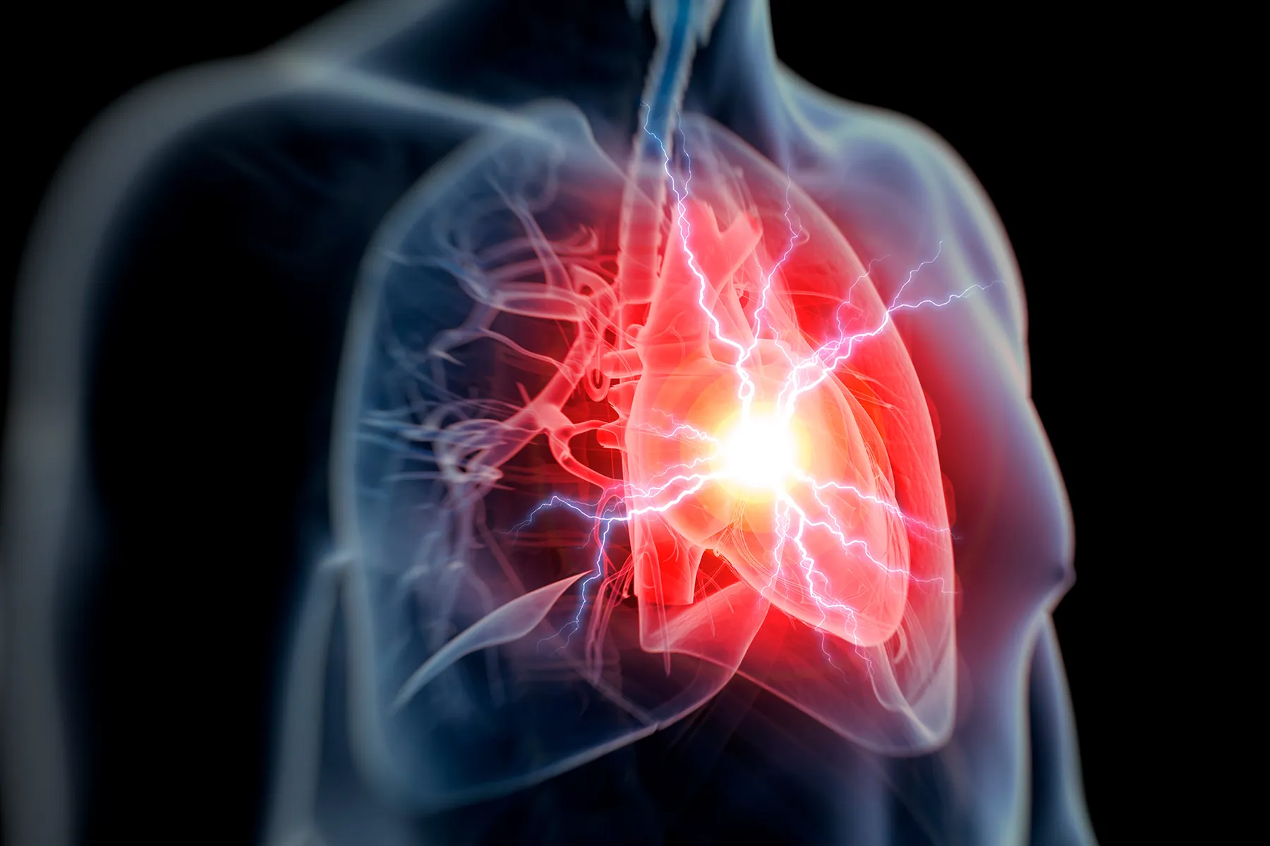 Upper body Agony and Other Indications