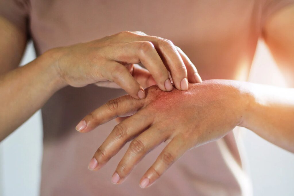 Winter season Pores and skin Woes? Here’s What to Do – and What Not to Do