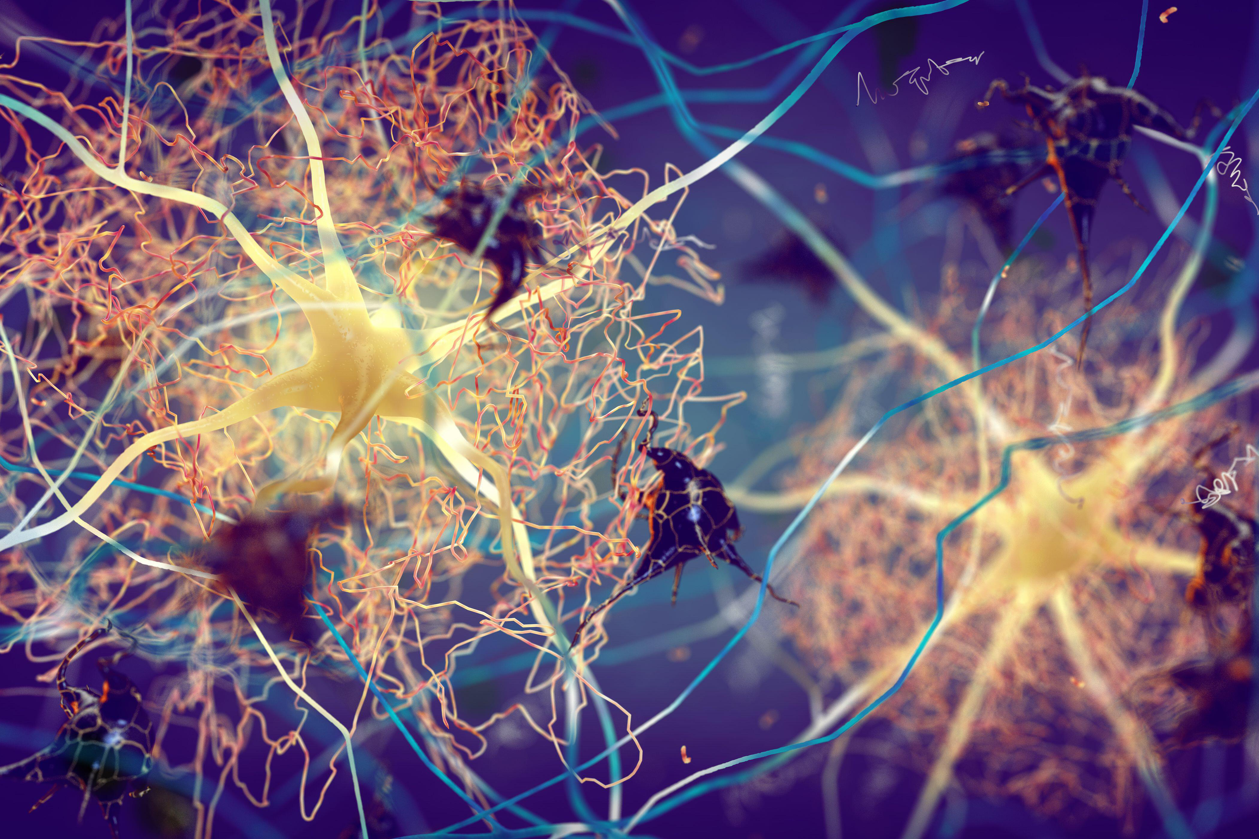 Could Blood Transfusions and Tissue Transplants Unfold Certain Dementias?