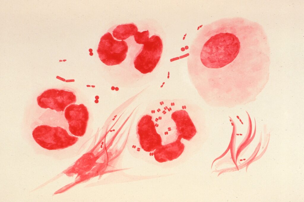 New At-Dwelling STI Test Could Assistance Cease the Spread of An infection